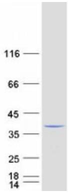 Coomassie blue staining of purified CRK protein.
